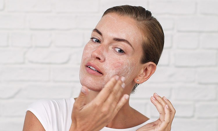 best exfoliators for acne