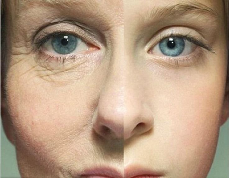 best Anti-Aging Wrinkle Creams